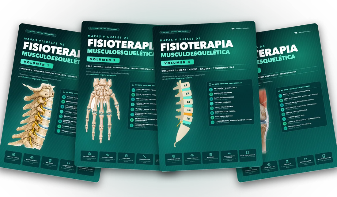 Los cuatro volúmenes de Mapas Visuales de Fisioterapia Musculoesquelética